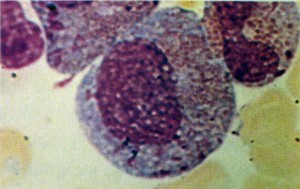 Promiel&oacute;cito eosin&oacute;filo