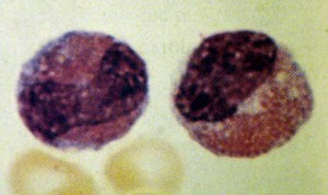 Dois metamiel&oacute;citos eosin&oacute;filos