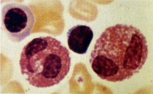 Dois leuc&oacute;citos eosin&oacute;filos