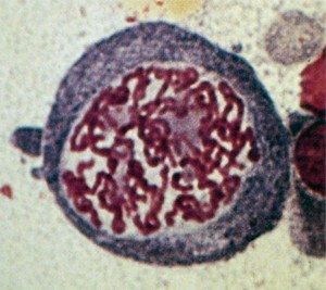 Est&aacute;gio I: profase (em megaloblasto)