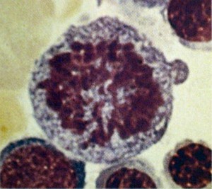 Est&aacute;gio II: met&aacute;fase tardia (proeritroblasto)