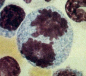 Est&aacute;gio III: an&aacute;fase (promieloblasto ou promon&oacute;cito)