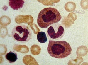 Est&aacute;gio IV: tel&oacute;fase (miel&oacute;cito eosinof&iacute;lico)